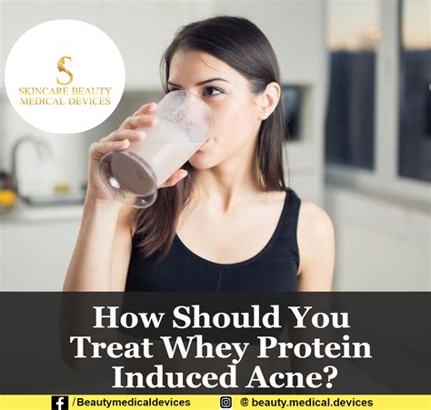 is whey protein bad for acne is an interesting topic that has been debated in the beauty and nutrition communities. On one hand, some people believe that consuming whey protein can help reduce acne breakouts due to its ability to boost metabolism and provide essential amino acids. However, others argue that excessive consumption of whey protein can actually worsen acne conditions by increasing inflammation and disrupting hormonal balance. Ultimately, it comes down to individual skin types and dietary habits, and it's important to find a balanced approach that works best for you.